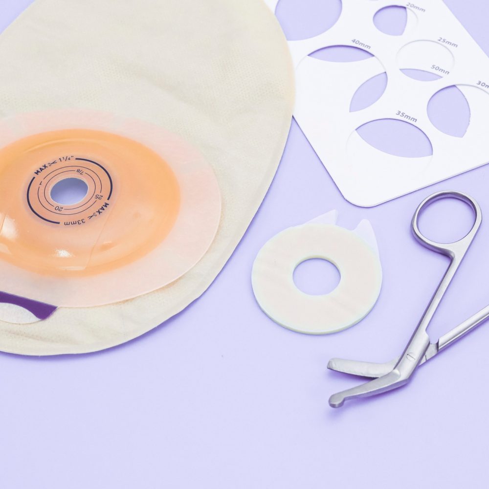 A colostomy bag, a stencil with sizes of different diameters and medical scissors lie on a lilac.